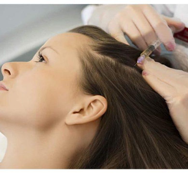 Mesotherapy for Hair