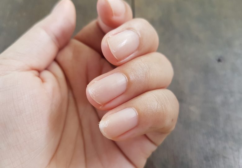 Nail Problem Nail Problem